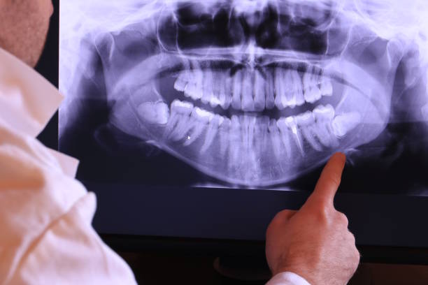 Best Emergency Dentist for Knocked-Out Tooth in Homosassa Springs, FL